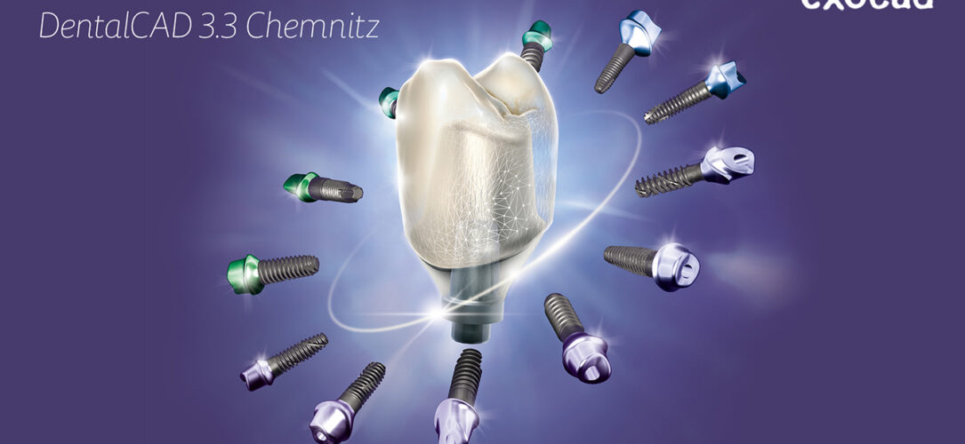 exocad gibt das öffentliche Release von DentalCAD 3.3 Chemnitz bekannt.