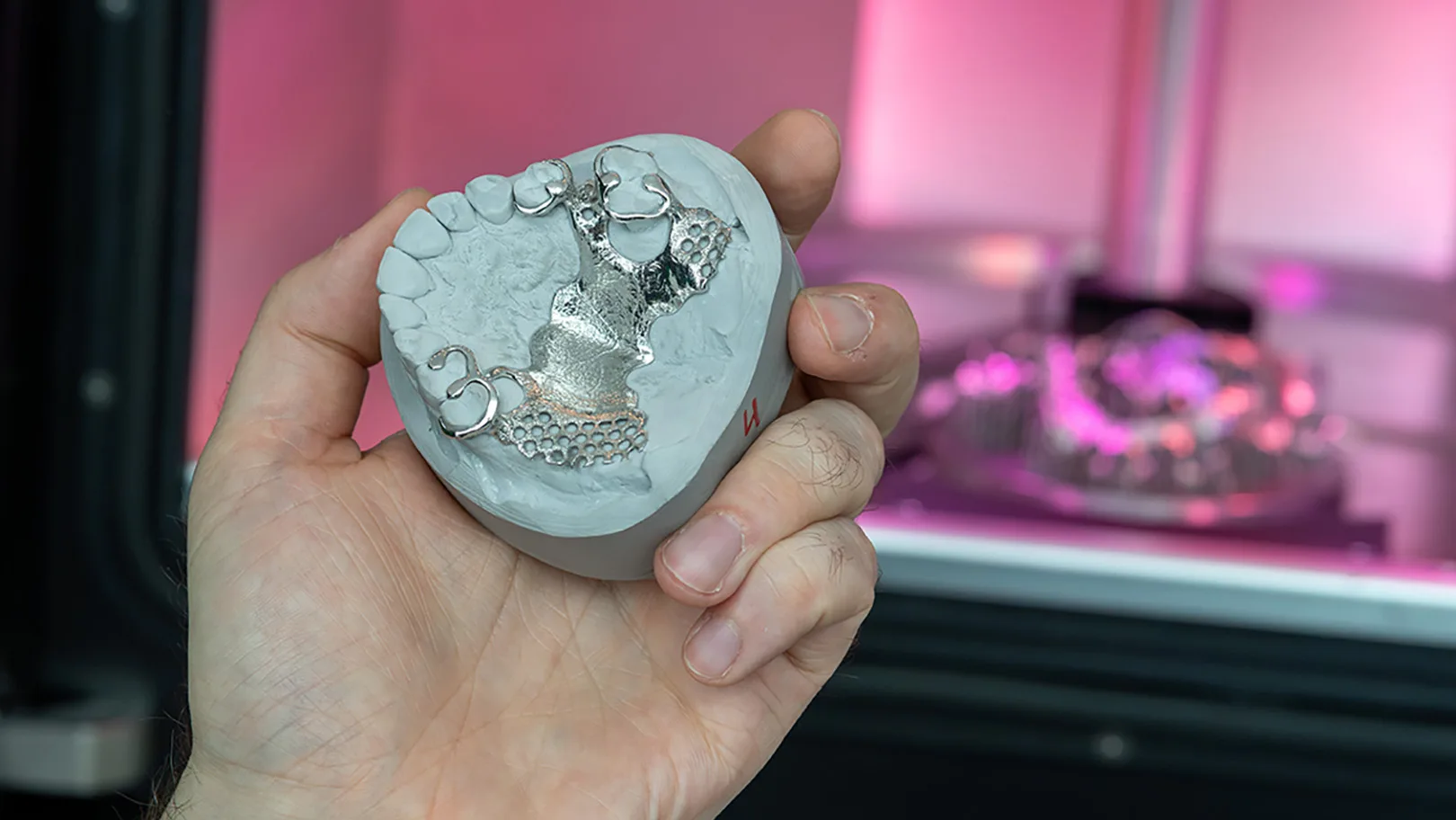 Zahnmodell Zahntechnik vor pinkem Hintergrund