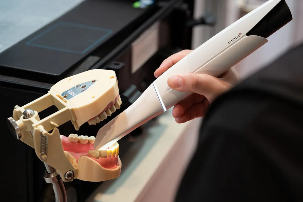 Intraoralscanner am Kiefermodell