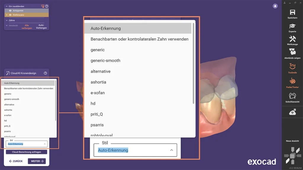 verschiedene Einstellungen