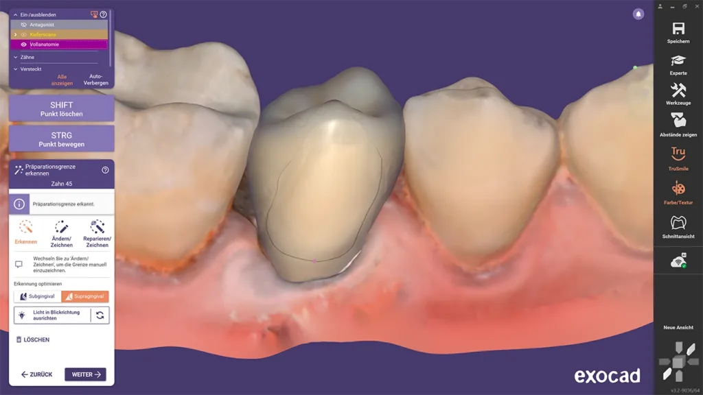 Ein Screen von Zähnen