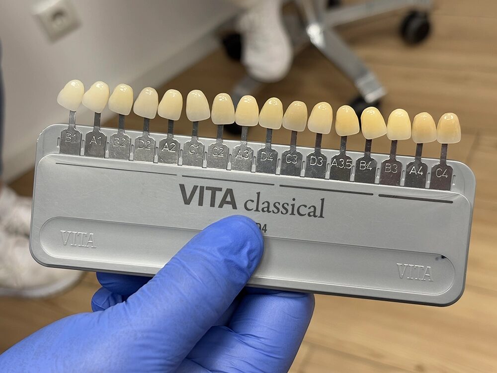 Anordnung der Vita-Farbstäbe