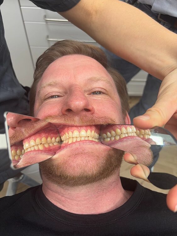 mit Spiegeln im Mund werden alle Perspektiven des Gebisses sichtbar gemacht