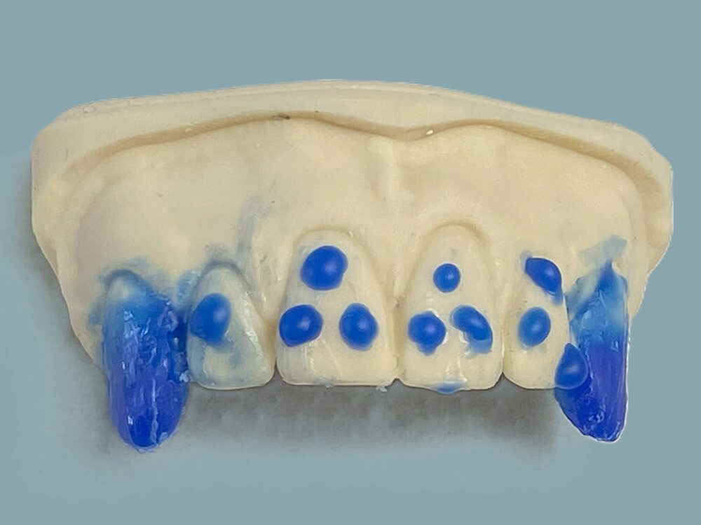 Ein aus Wachs geformtes Gebiss
