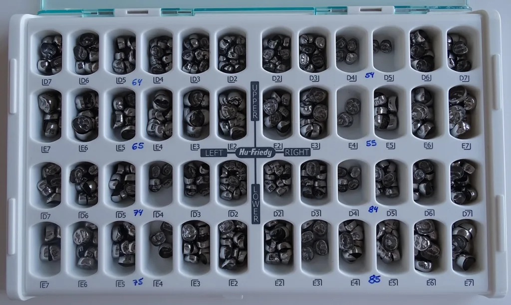 Verschiedene Zahnmodelle.