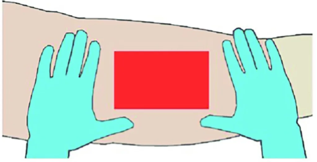 Abbildung von zwei Händen auf einem Arm