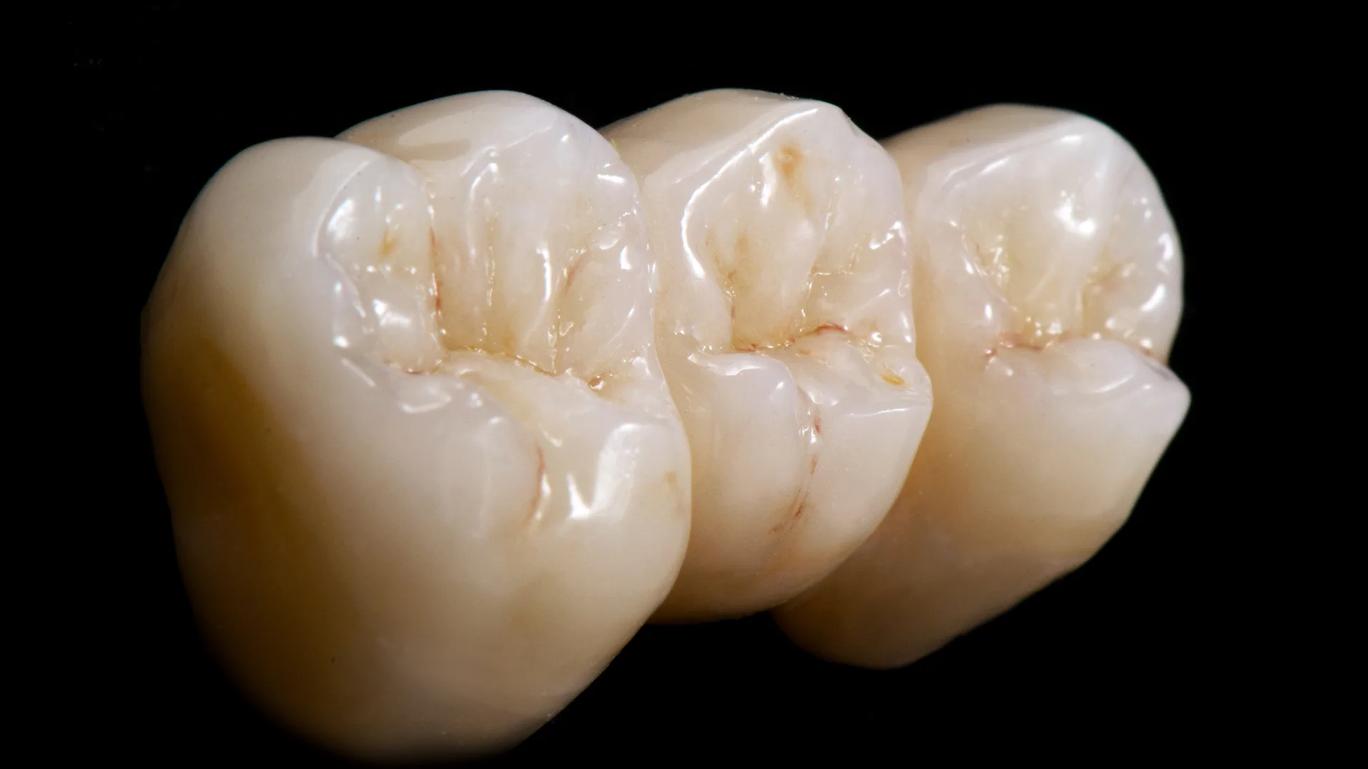 Zähne vor einem schwarzen Hintergrund.