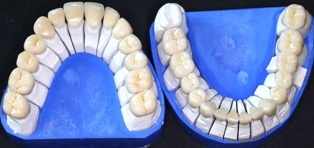 Abb. 11: Finish auf den Modellen