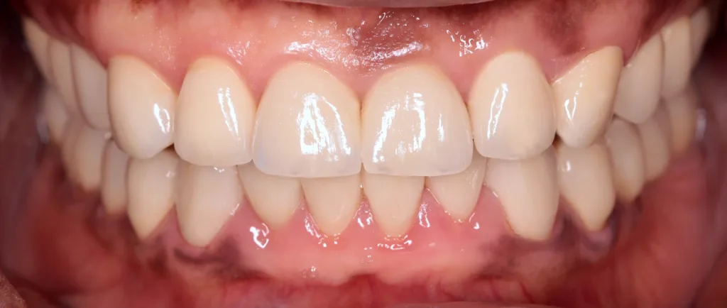 Abb. 15: Komplette Arbeit in situ