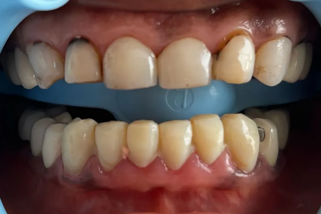 Abb. 2: Close-up der Ausgangssituation