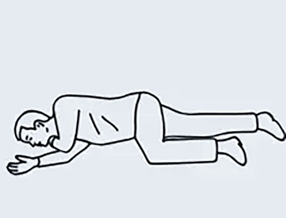 Illustration der stabilen Seitenlage