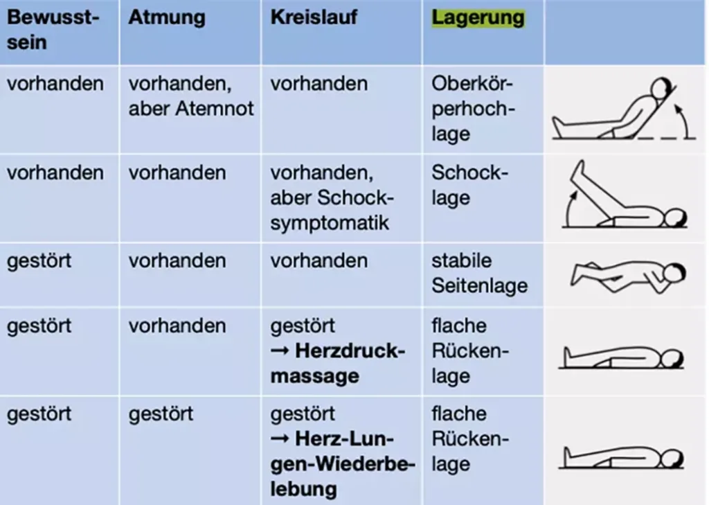 Tabelle der verschiedenen Positionen