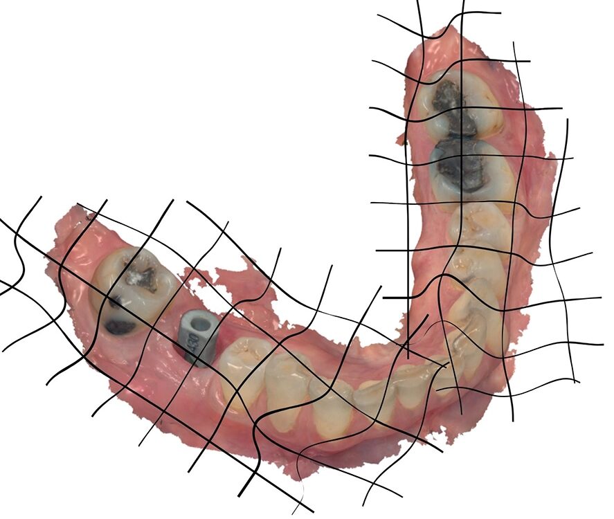 Ein Scanabdruck eines Gebisses.