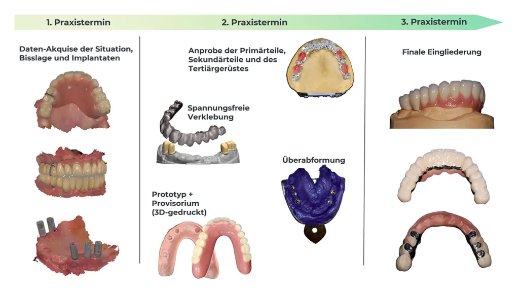 Das Beispiel eines smarten Workflows für eine herausnehmbare Indikation mit insgesamt nur drei Praxisterminen.