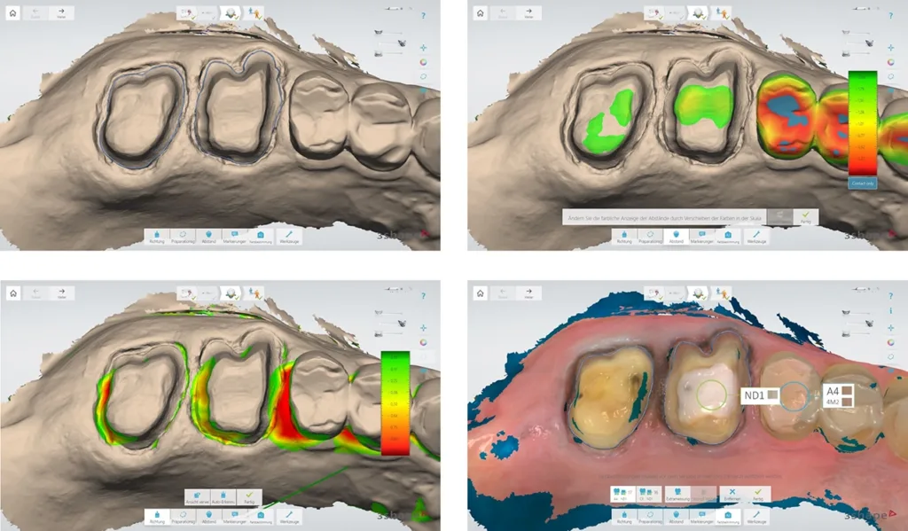 Die Selbstkontrolle mit verschiedenen Tools der Scansysteme ermöglicht den Behandelnden eine genaue Beurteilung der Qualität ihrer Scandaten