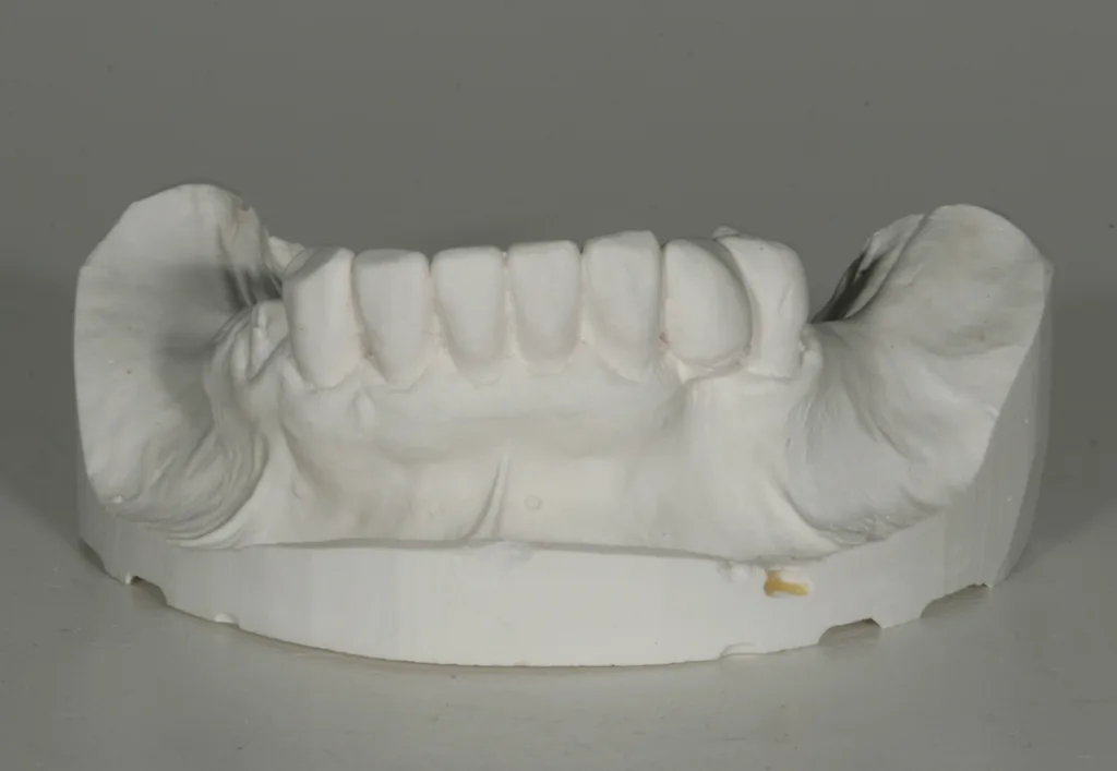 Ein geformtes Gebiss