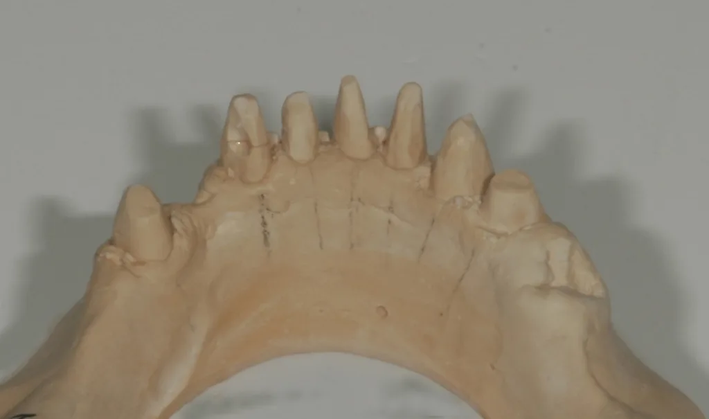 Markierungen zum Pinsetzen