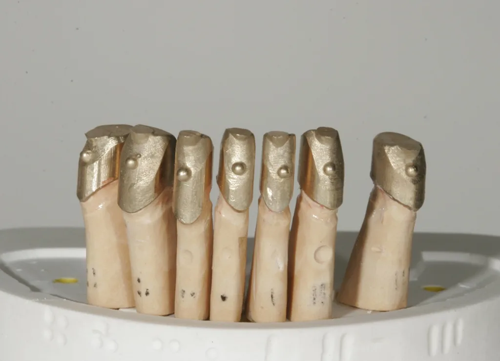 Aufgepasst und Ränder ausgearbeitet