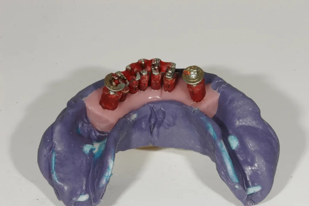 Beschneiden der Enden