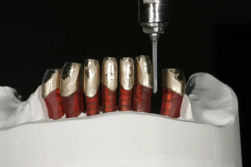 Einstellen des Frässockels