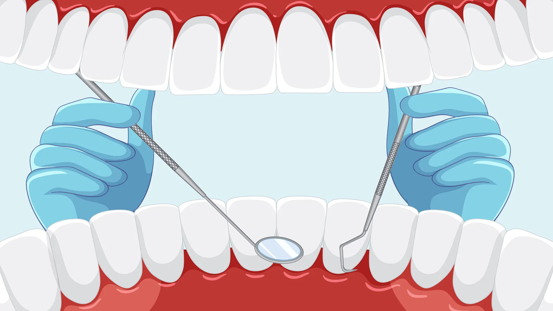 Illustration eines Gebisses, welches untersucht wird.