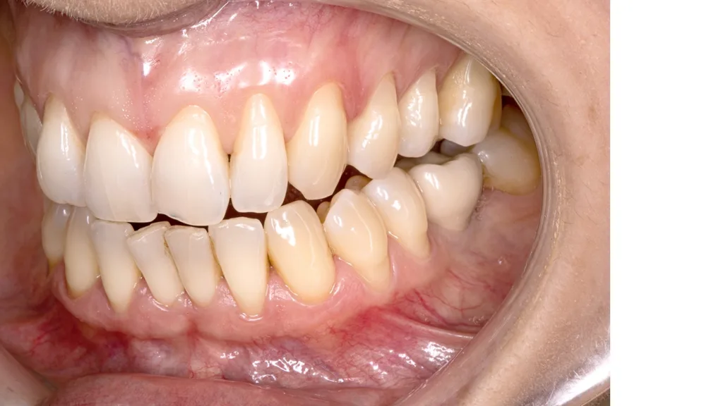 Unterbelichtung und Überbelichtung beeinträchtigen die Bildqualität.