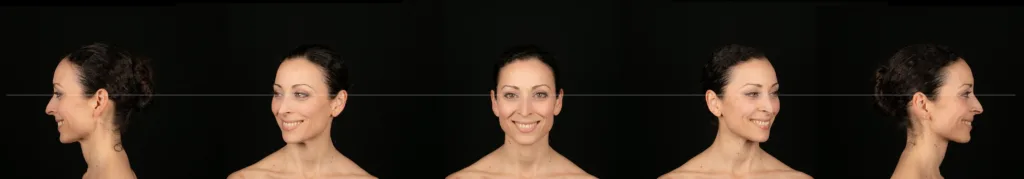 Lächeln in drei Ansichten (Frontal 0°, 45°-Halbprofil, 90°-Profil links und rechts)