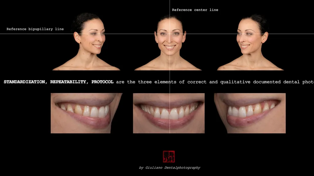 Richtige Position des Gesichts und des Profils (Interpupillarlinie, Gesichtsmittellinie)