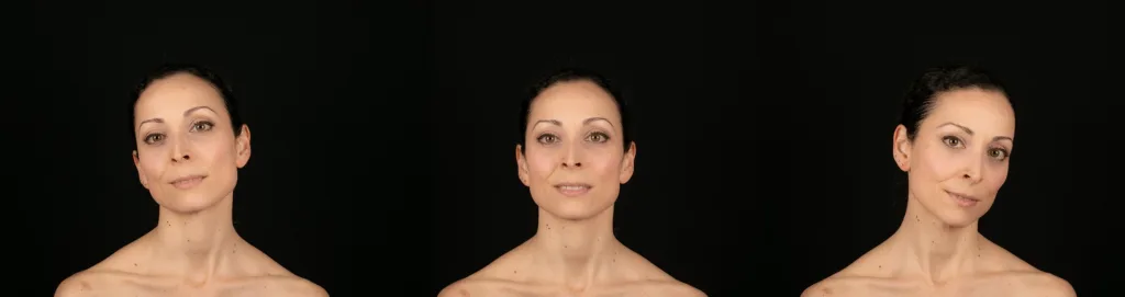 Sollte für die Dokumentation vermieden werden: seitlich abweichende Kopfhaltung