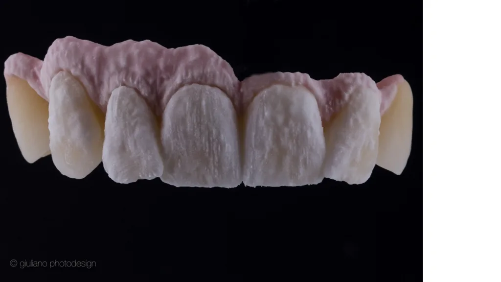 Kameraeinstellung, Beleuchtungsintensität und Kamerawinkel entscheiden, ob Farbdetails oder morphologische Oberflächen hervorgehoben werden sollen.