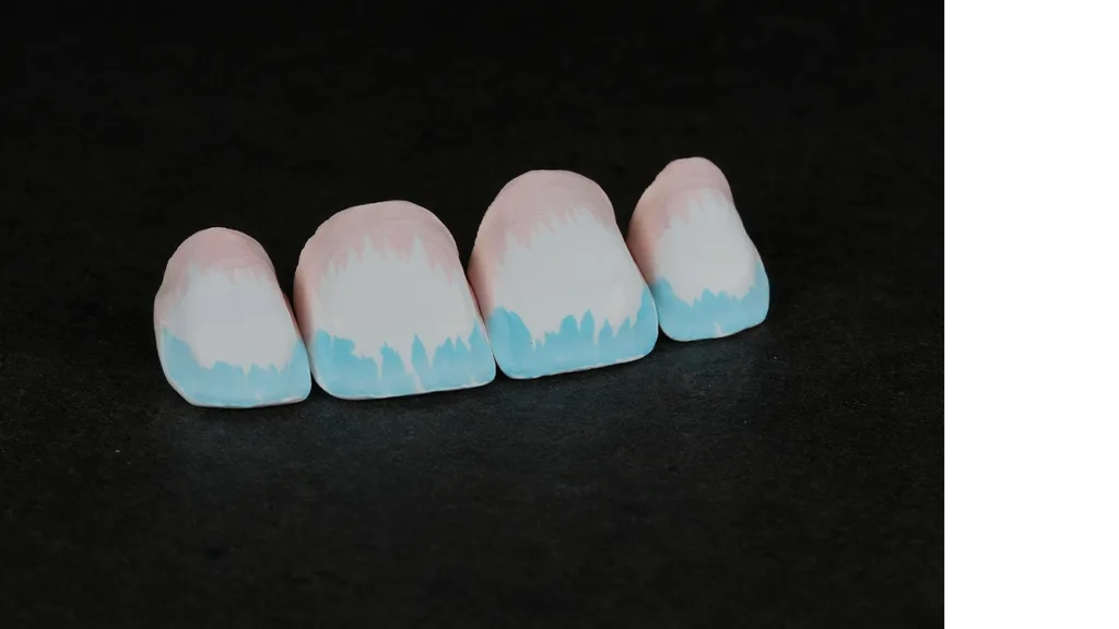 Auf die zervikalen und inzisalen Bereiche der Kronen aufgetragene Effektflüssigkeiten