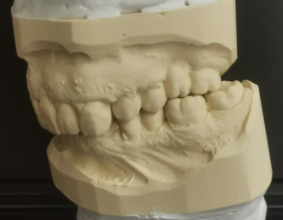 Abb. 1: Patientensituation Ansicht rechts.