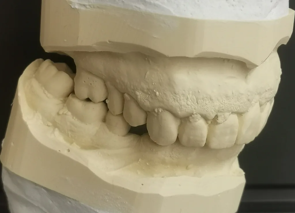 Abb. 2: Patientensituation Ansicht links.