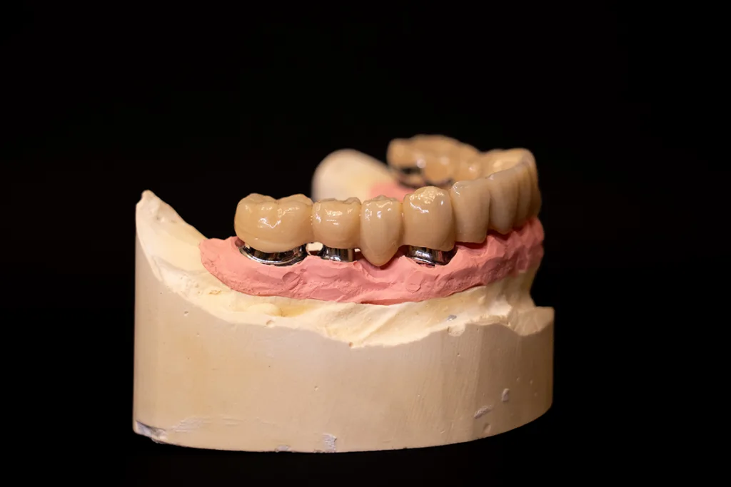 Abb. 26: Die Brücke gleitet optimal auf die Primärteleskope (UK).