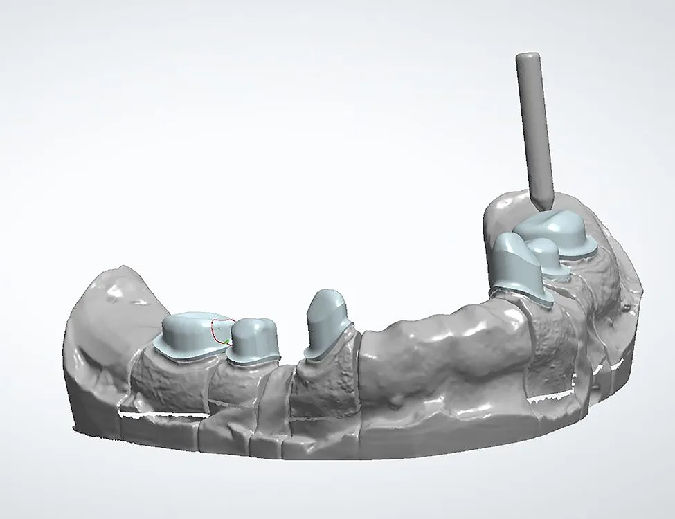 Abb. 7: Die entworfenen Primärteleskope.