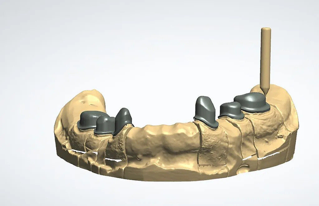 Abb. 9: Fertig designte Primärteleskope UK in frontaler Ansicht.