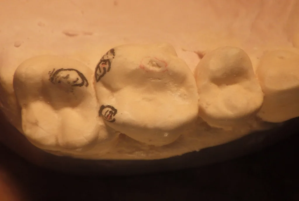 Abb. 2: 26 und 27, bevor sie eingeschliffen wurden.