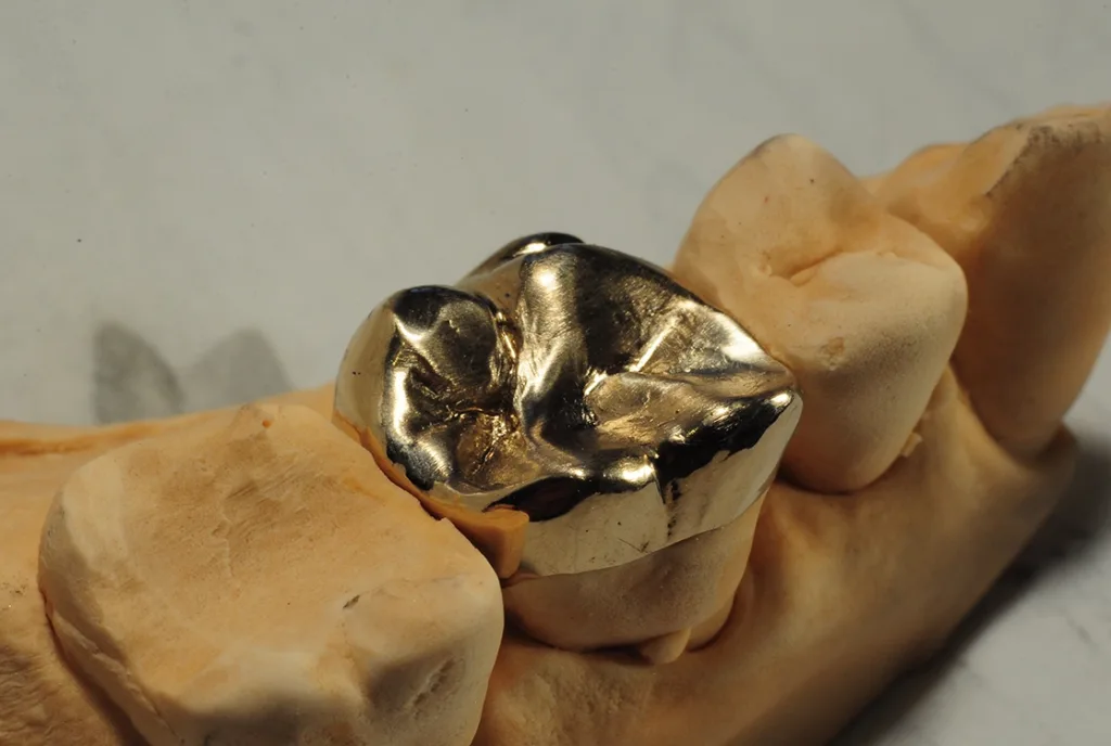 Abb. 4: Neues Gold-Overlay auf dem Modell.