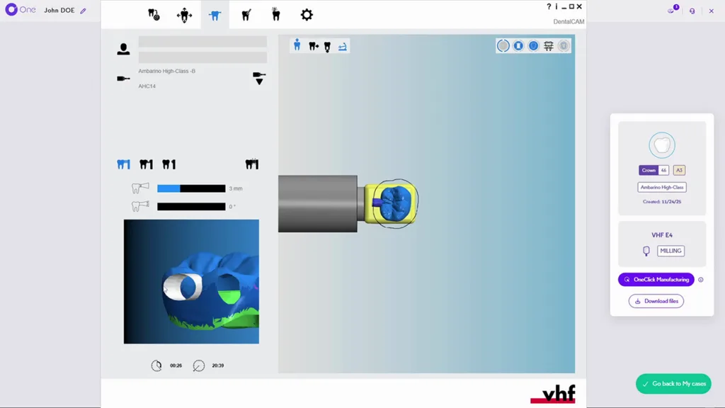 Nahtlos anschließendes Nesting in dentalcam: Per OneClick Manufacturing werden die in Circle One gestalteten Restaurationen übergeben und in dentalcam im Materialblock positioniert sowie mit Haltesteg versehen. Anschließend wird direkt gefräst.