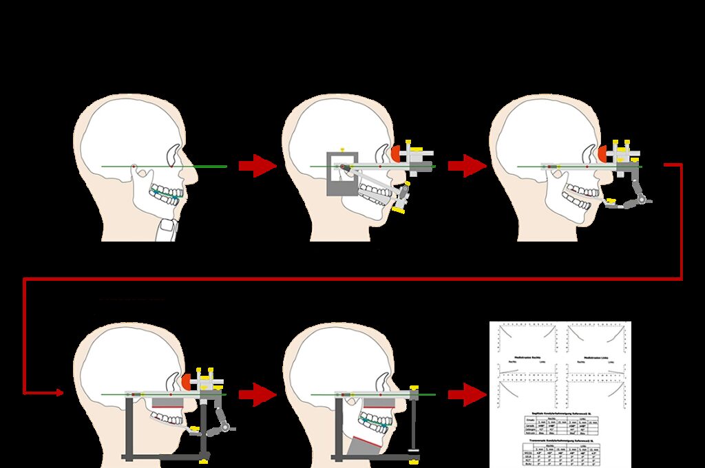 Abb. 5: Schema der Modellmontage.