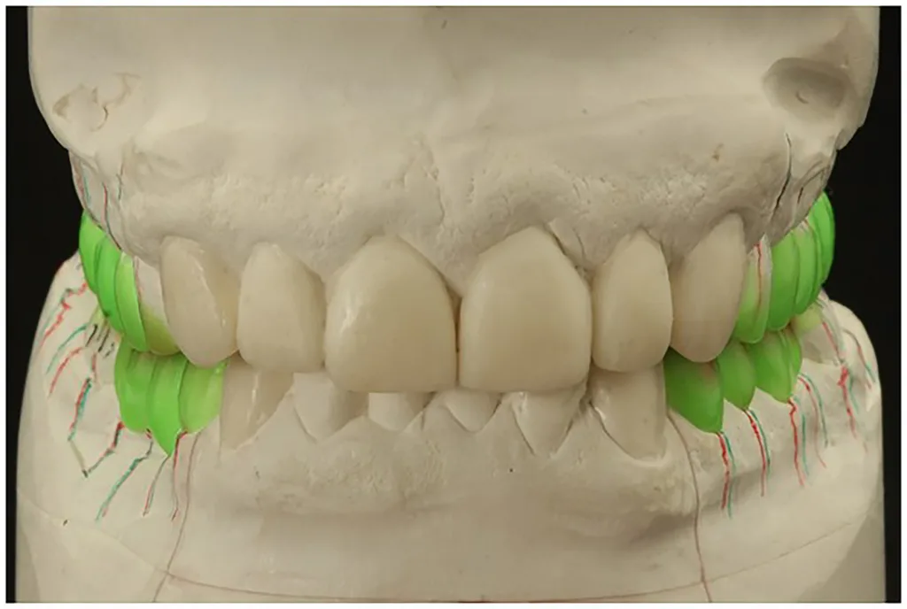 Abb. 6 a-e: Diagnosewachsung.