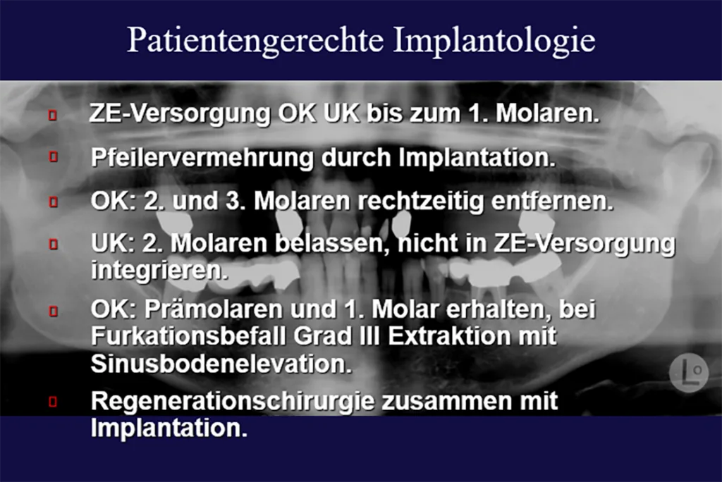 Abb. 13: Medizingerechte wirtschaftliche Behandlungsstruktur in der Implantatversorgung zur Vermeidung von Übertherapie.
