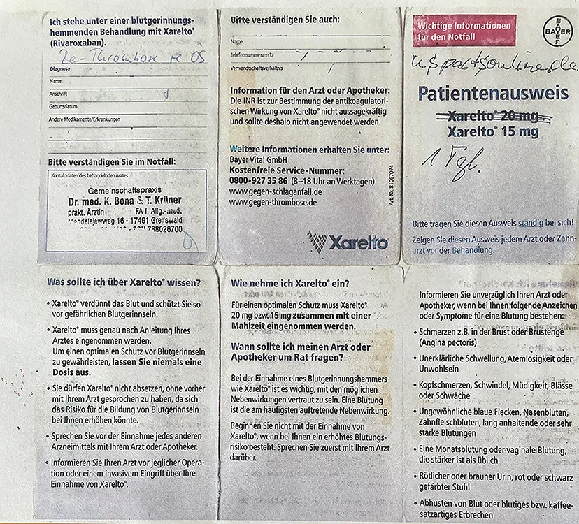 Abb. 4 a-g: Klinische und radiologische Dokumentation eines 48-jährigen männlichen Patienten (geb. 15.8.1977) mit generalisierter Parodontitis Stadium III Grad C [24]. Der Patient hatte vor ca. 20 Jahren in Folge eines stationären Aufenthaltes nach einem Autounfall eine zunächst nicht diagnostizierte und adäquat therapierte Beckenvenenthrombose erfahren müssen. Seit diesem Zwischenfall wurde er medikamentös mit unterschiedlichen Gerinnungshemmern antikoaguliert. Aktuell nimmt er täglich einen Gerinnungshemmer mit dem Markennamen Xarelto® (Bayer Vital) und dem Wirkstoff Rivaroxaban ein.