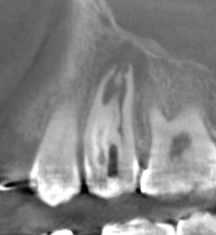 Abb. 2: Kleinvolumige, hochauflösende DVT.