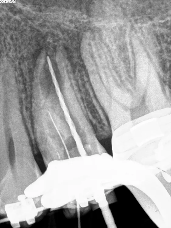 Abb. 5: Instrumentenkontrastaufnahme.