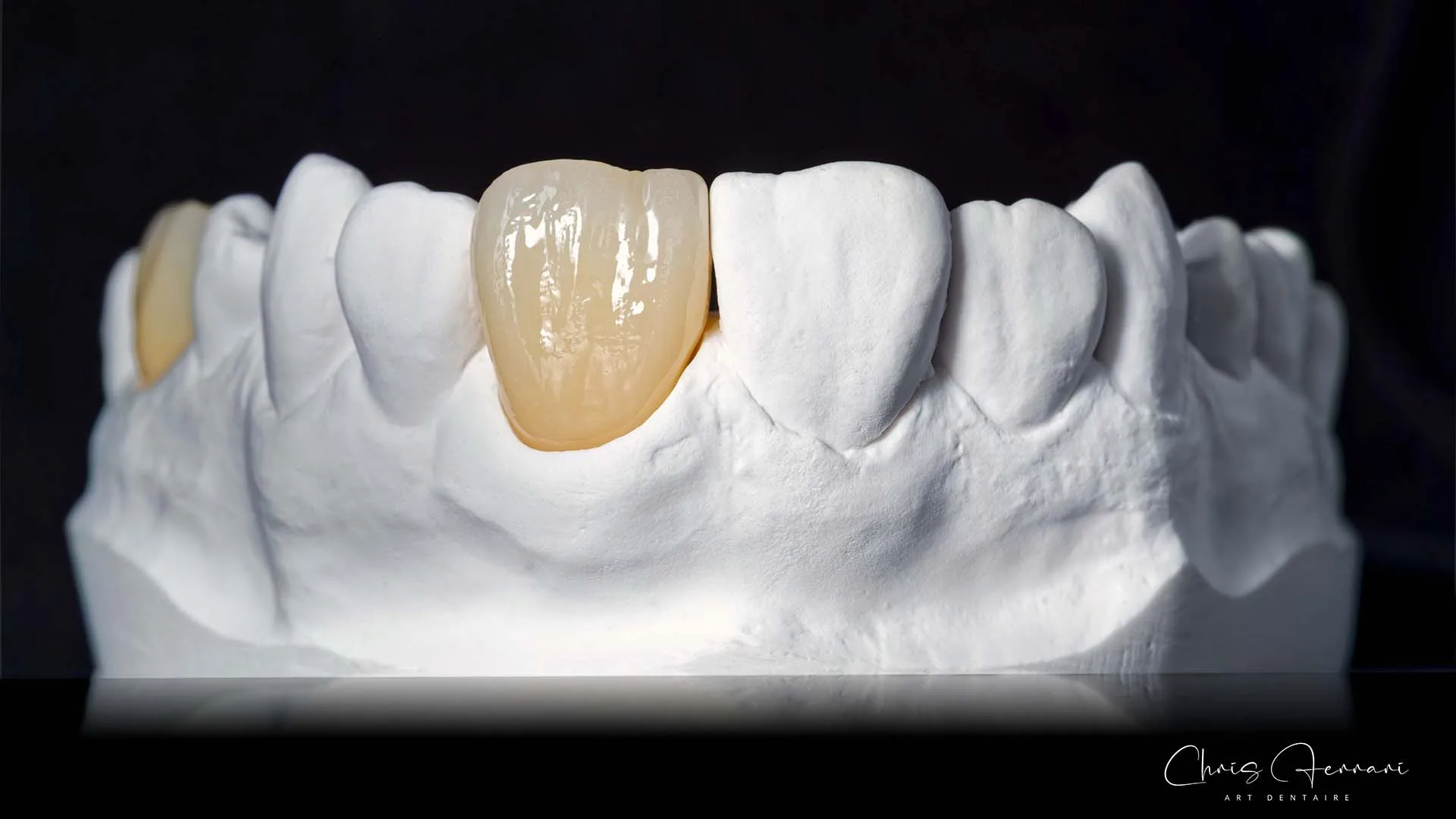 Dank der farblich abgestimmten Pasten mit 3D-Effekt erzielen Anwender maximal ästhetische Ergebnisse.