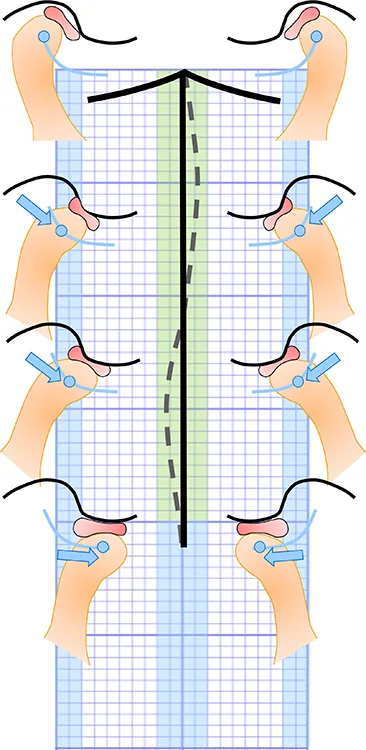Abb. 2a: Darstellung der physiologischen Bewegungsquantität und -qualität in der Frontalebene. Bewegungsumfänge bis in die blau schattierten Randbereiche und Deviationen bei Kieferöffnung innerhalb der grün schattierten Bereiche sind als physiologisch zu werten (1 Kästchen entspricht 1 mm).