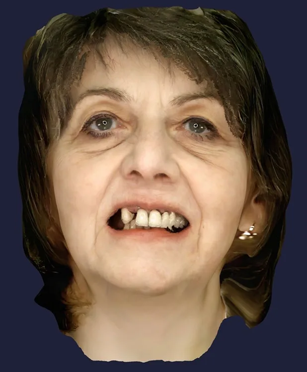 Abb. 5a: Facescan von Patientin