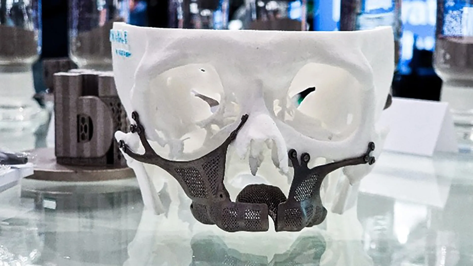 Noch heute bestehen über 90 Prozent aller Dental- und orthopädischen Implantate entweder aus Ti 6Al 4V oder Reintitan.
