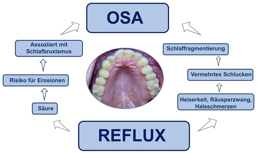 Abb. 10: Zusammenhänge zwischen OSA und GERD.